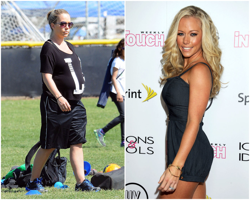 Kendra Wilkinson – 25 kilos | Getty Images Photo by Chinchilla/Bauer-Griffin/GC & Photo by Valerie Macon
