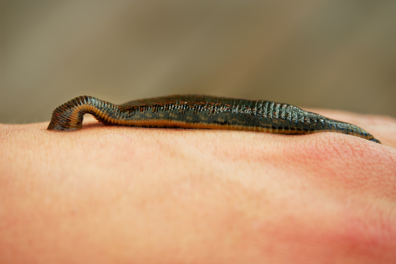 Were the Leeches Fake or Real? | Shutterstock