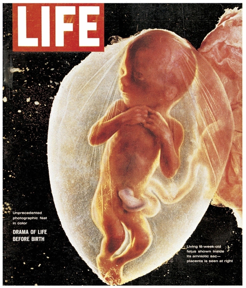 The First Photo of a Living Fetus | Getty Images Photo by Photo 12/Universal Images Group