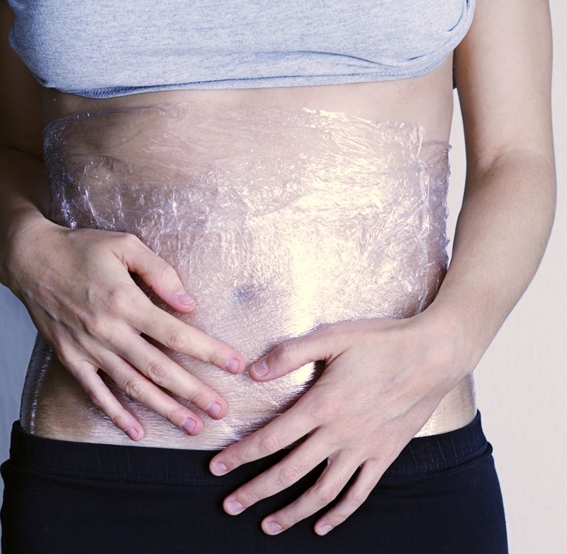 Full Marks for Stretch Marks | Getty Images Photo by luckyj1