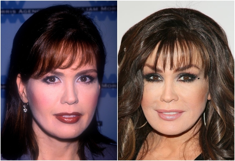 Did Marie Osmond Have Plastic Surgery? | Alamy Stock Photo by MediaPunch Inc & Getty Images Photo by Jean Baptiste Lacroix/WireImage
